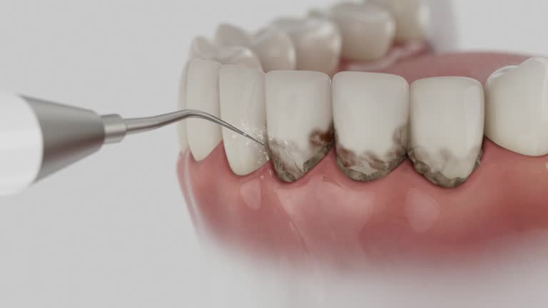Reliable Invisalign Clear Aligners contractor in St. Robert, MO by Smile Center Dentistry